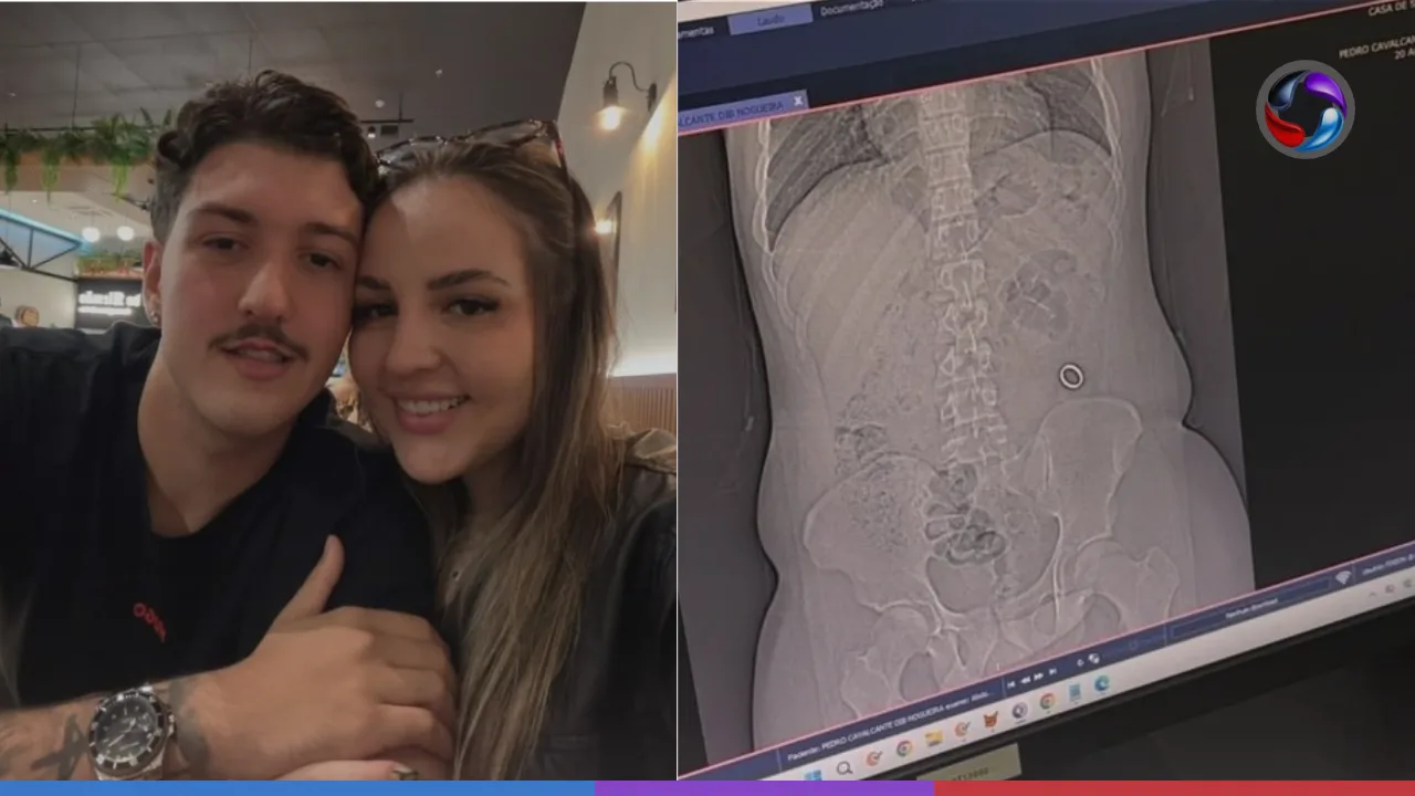 Jovem de Santos viraliza após engolir a própria aliança sem querer.
